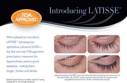 Contact Urban Eyes Optometry to discuss Latisse: 415.863.1818 or urbaneyes@aol.com